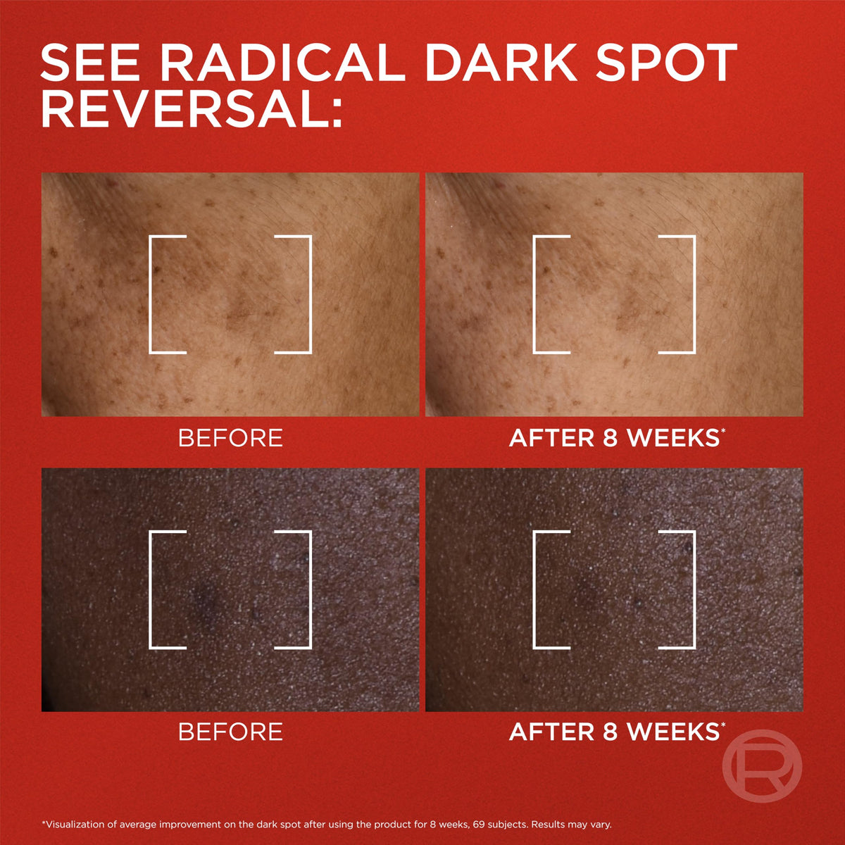 L'Oreal Paris ingredient focus with Melasyl and Vitamin C visuals showing brightening actives