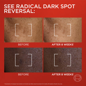 L'Oreal Paris ingredient focus with Melasyl and Vitamin C visuals showing brightening actives