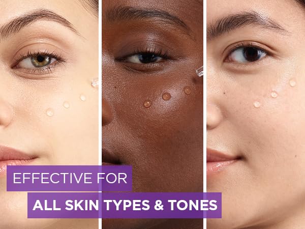 L'Oreal Paris before-and-after visual concept showing improved skin plumpness and moisture