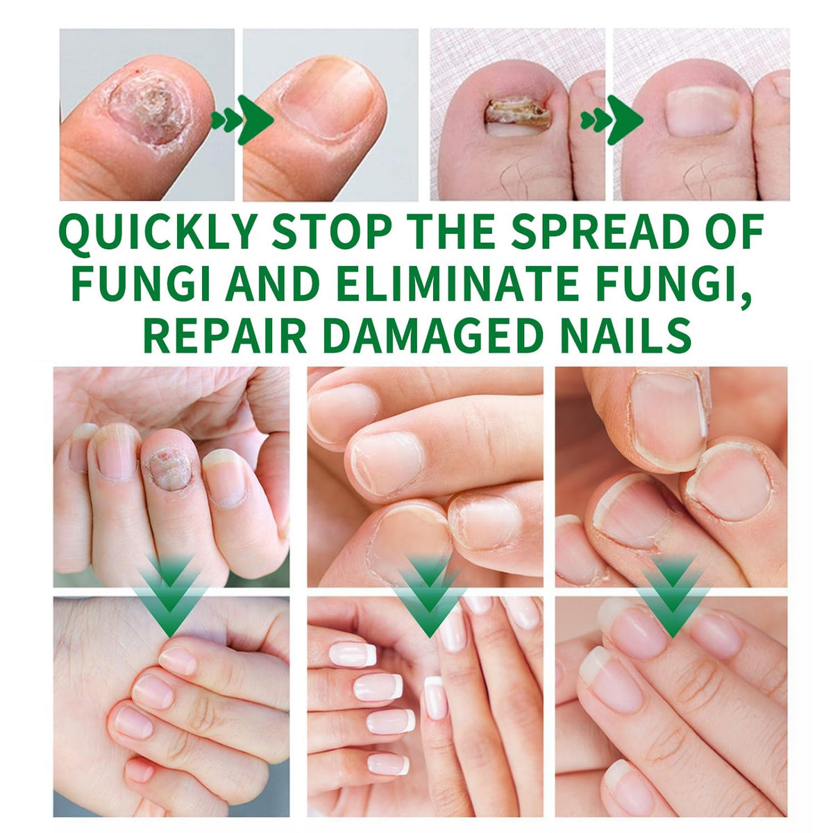 LOYOTICE cuticle massage in use illustrating quick absorption and improved cuticle condition
