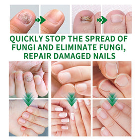 LOYOTICE cuticle massage in use illustrating quick absorption and improved cuticle condition