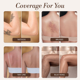LUMINESS before-and-after leg photo showing concealed tattoo benefit