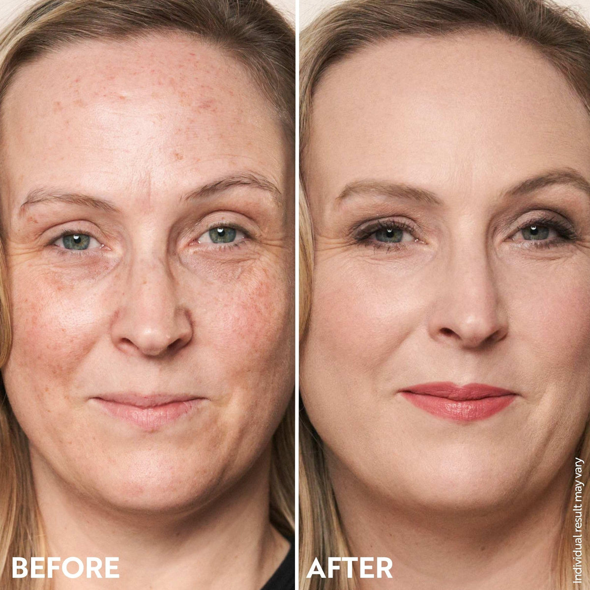 M. Asam before and after on model face showing visible redness reduction benefit