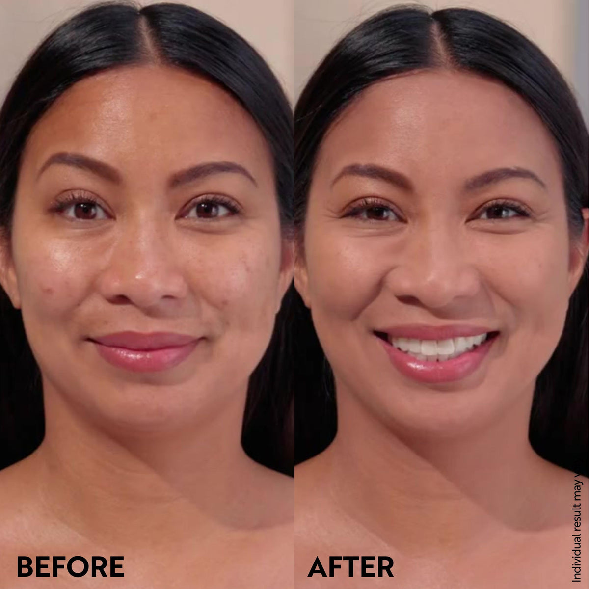 M. Asam before and after swatch showing reduced redness