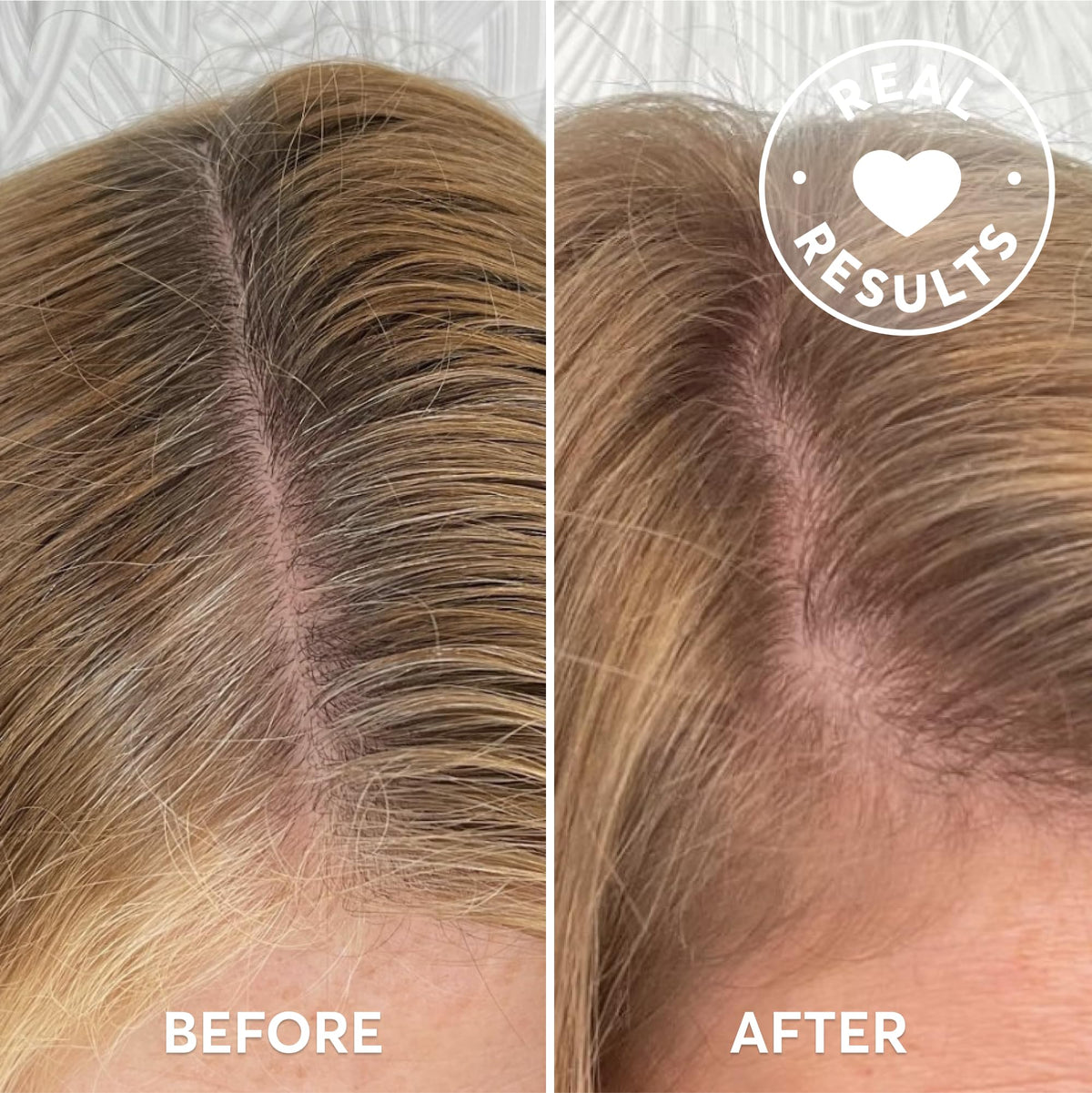 Madison Reed before and after part line demonstrating immediate gray coverage benefit