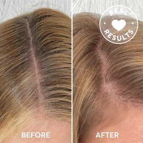 Madison Reed before and after part line demonstrating immediate gray coverage benefit