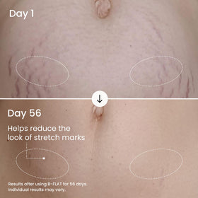 MAËLYS being applied to belly demonstrating coverage and gentle massage benefit