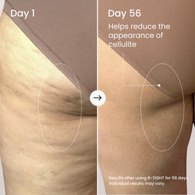 MAËLYS applied to thigh demonstrating easy massage-in method for smoother skin