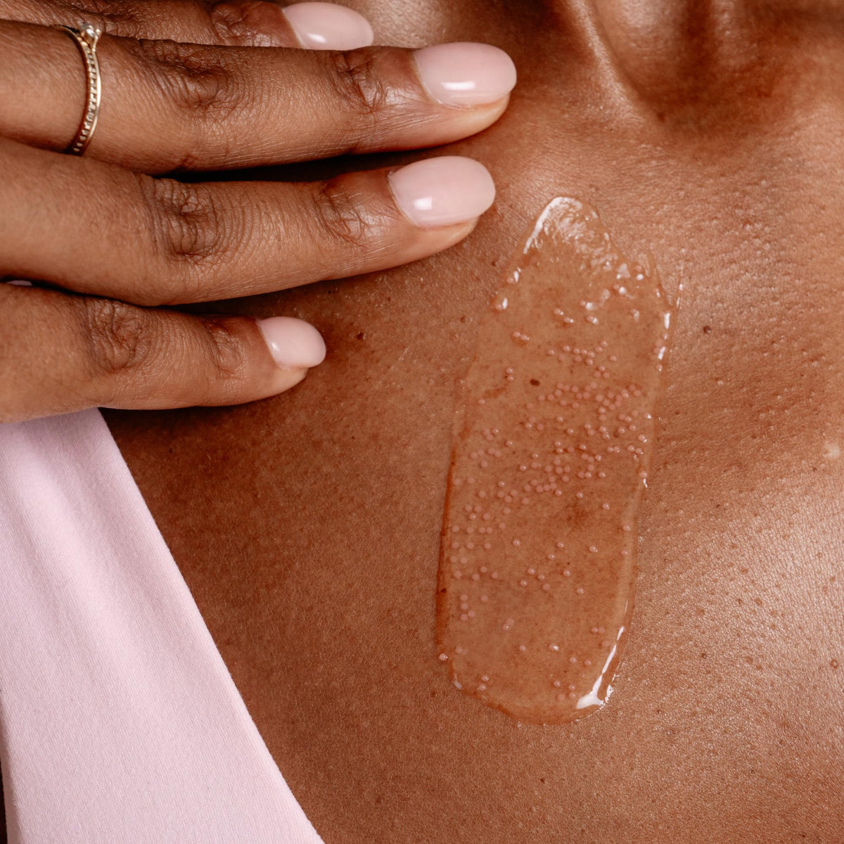MAËLYS before and after arm image illustrating improved texture and smoother look