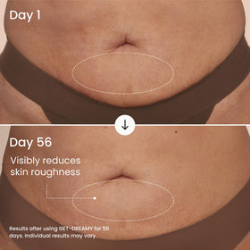 MAËLYS uva-ursi ingredient shot emphasizing targeted texture support