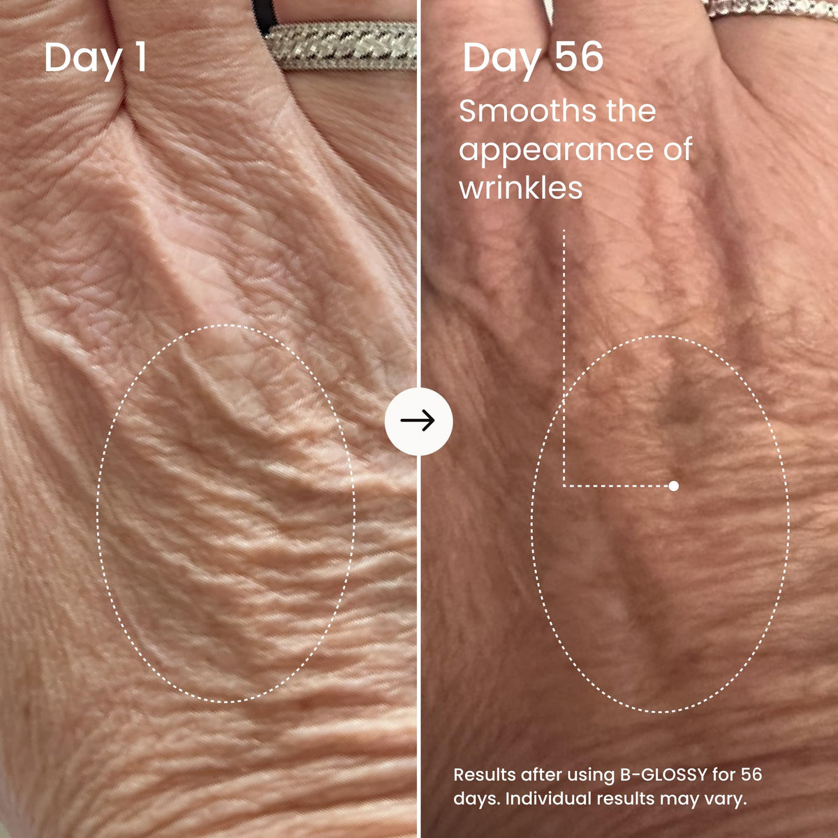 MAËLYS hyaluronic serum drop on skin showing lightweight texture and hydration