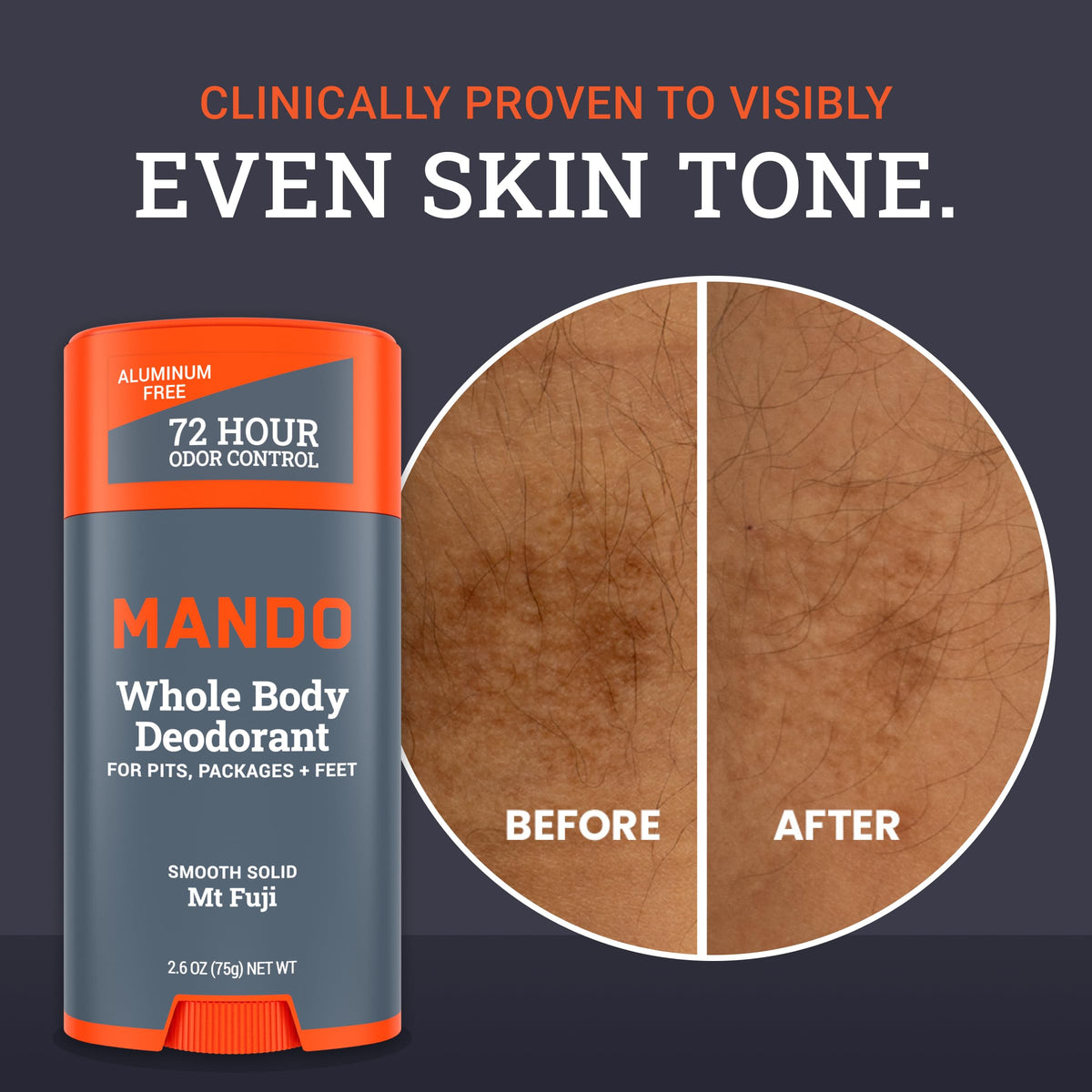 Applying Mando to feet to reduce odor and friction after activity