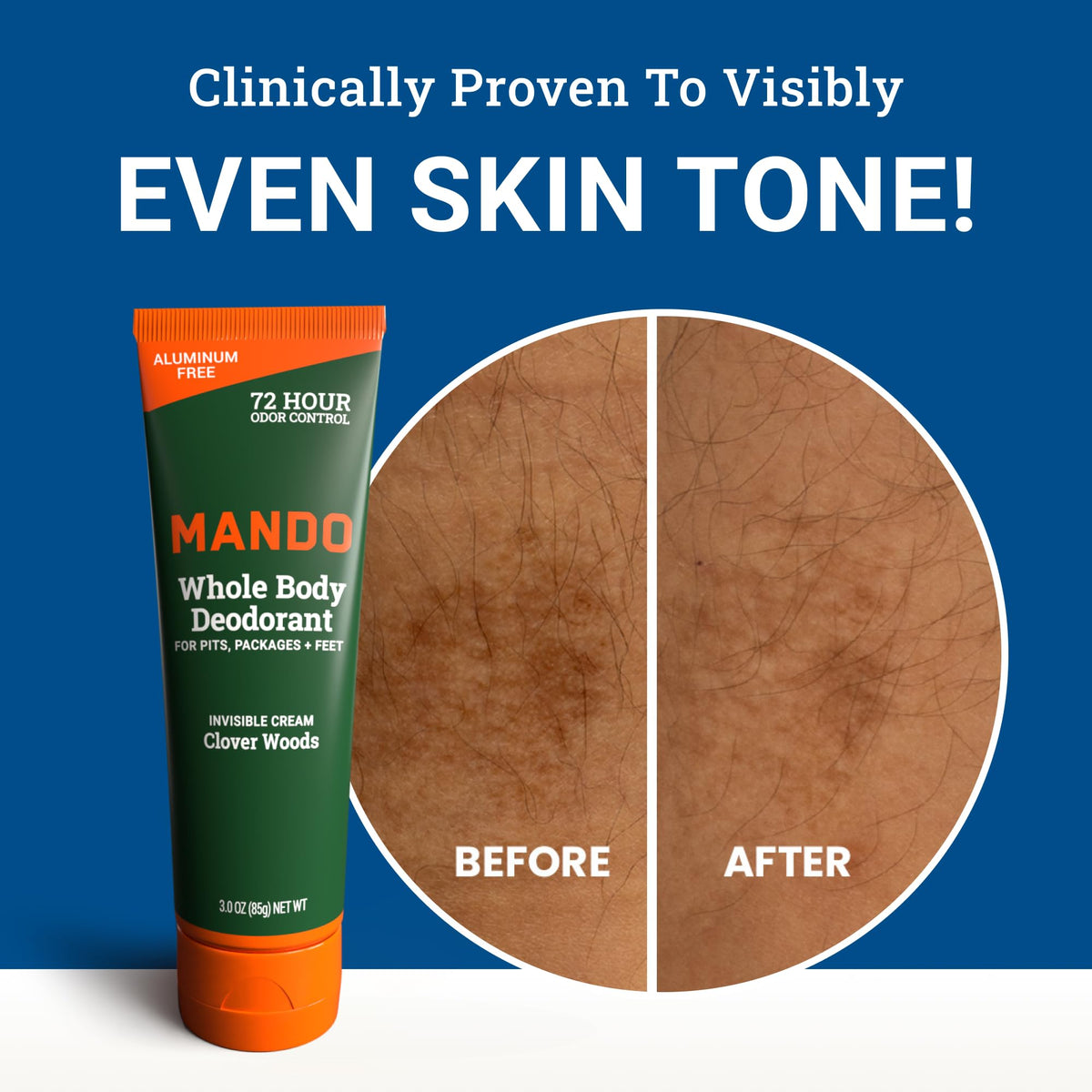 Mando applied to foot illustrating odor control after workouts