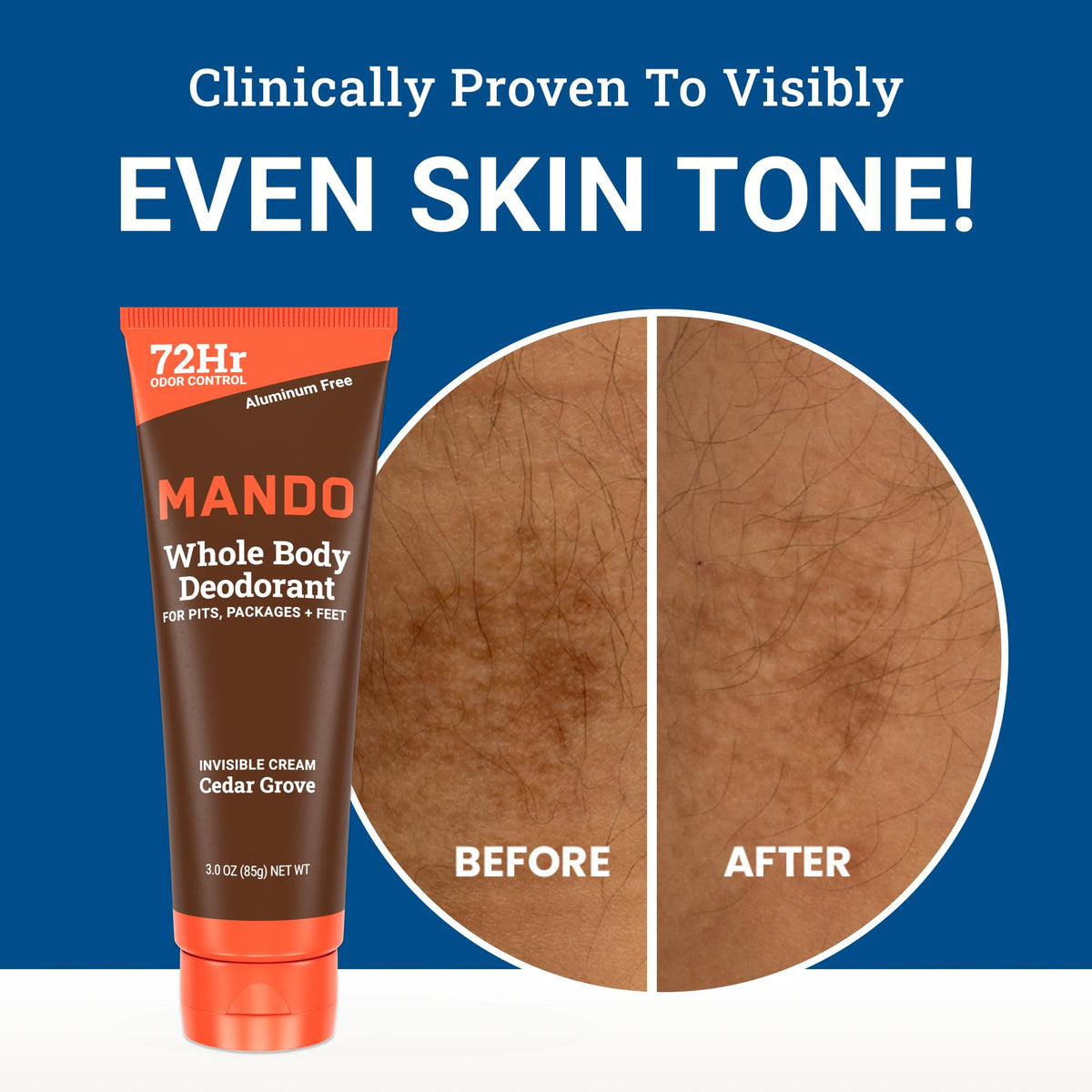 Mando applied to groin area illustrating gentle safe-for-intimate-use benefit