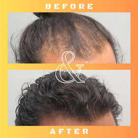 Mane Regain 30ml size comparison beside a coin to show travel-friendly volume benefit