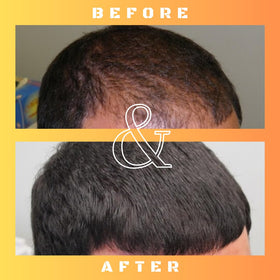 Mane Regain clear solution texture in vial demonstrating easy absorption benefit