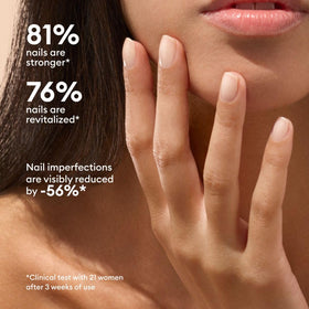 Application on nail close-up showing Manucurist ridge-filling effect