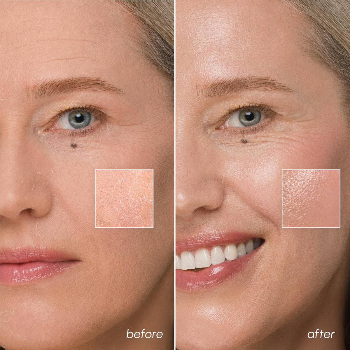 MAREE algae and Centella ingredients visual emphasizing natural support