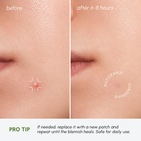 MAREE two sizes displayed side by side showing size options for different blemishes