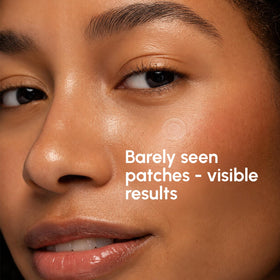 MAREE sheet of clear acne dots on backing showing easy peel and hygienic use