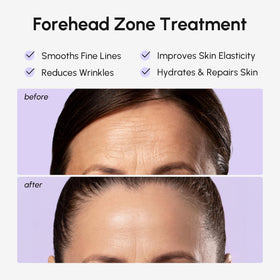 MAREE hydrogel texture detail highlighting moisture-rich formula and comfort