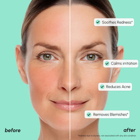 MAREE ingredient label highlighting centella and niacinamide benefits