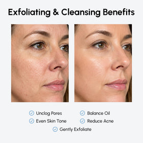 MAREE product label listing glycolic, salicylic and hydrating ingredients