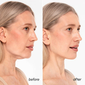 MAREE mask worn on model side profile demonstrating jawline contouring effect