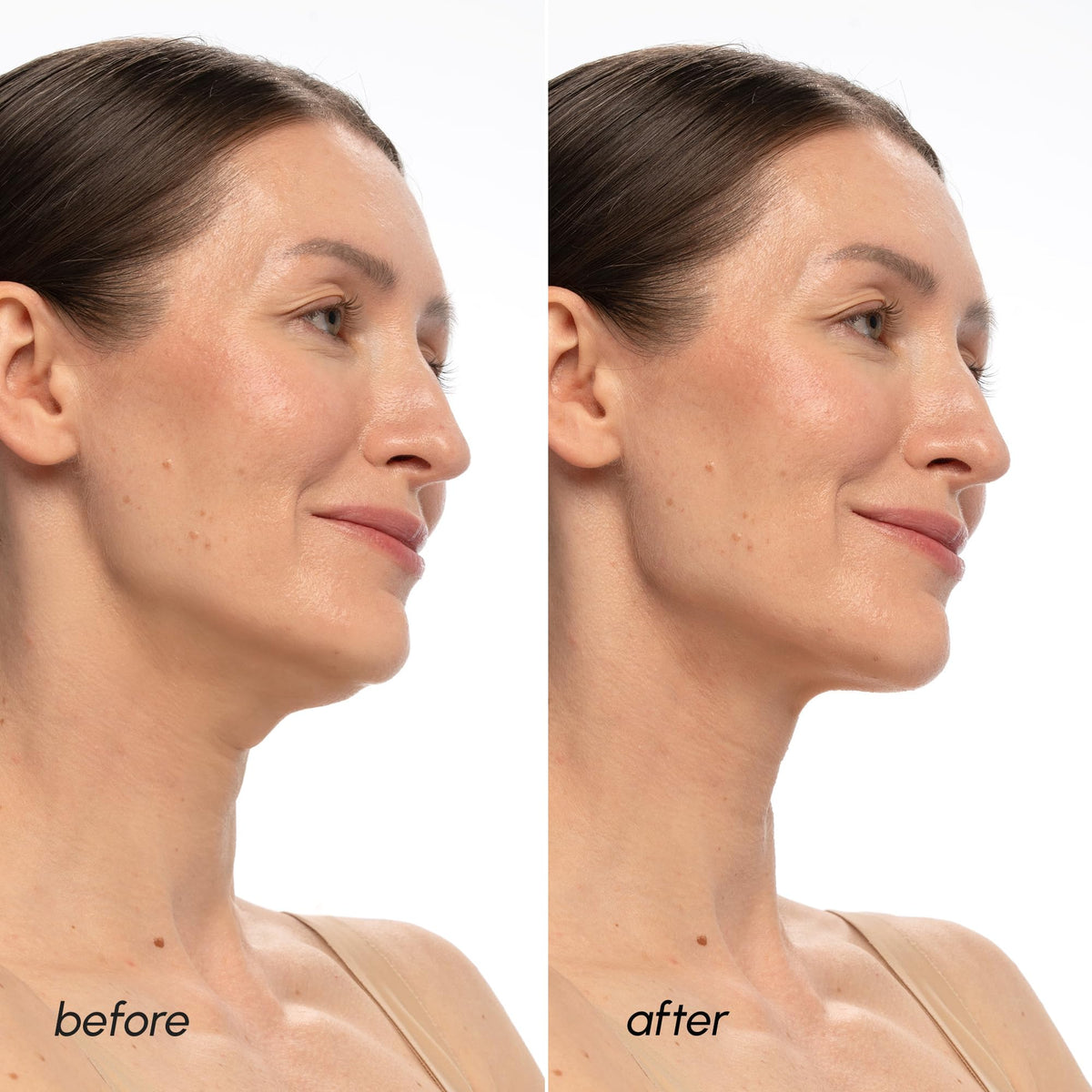 MAREE on model side profile wearing mask for visible jawline support