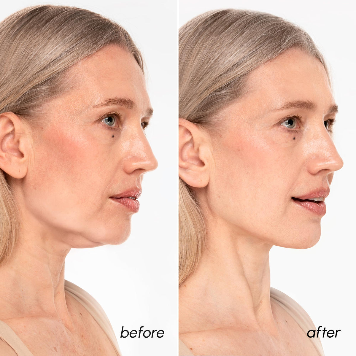 MAREE application detail on neck showing targeted coverage and firming