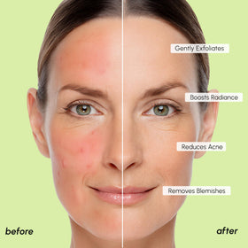 MAREE pad wiping cheek showing blemish-targeting and smoothing effect