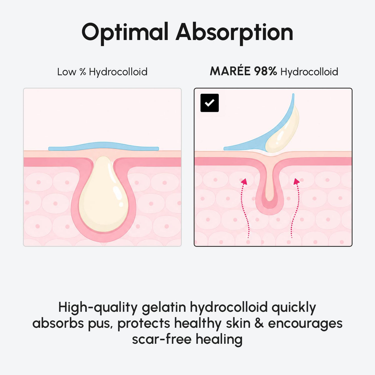 MAREE patch applied to cheek showing discrete protection and reduced picking benefit