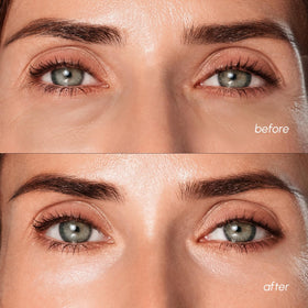 MAREE patches applied on model under-eye to show fit and soothing effect