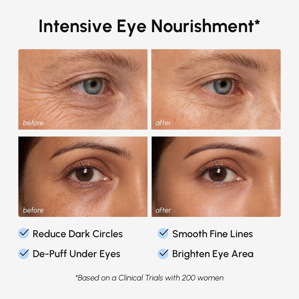 MAREE patches applied under eye demonstrating immediate depuffing effect