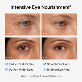 MAREE patches applied under eye demonstrating immediate depuffing effect