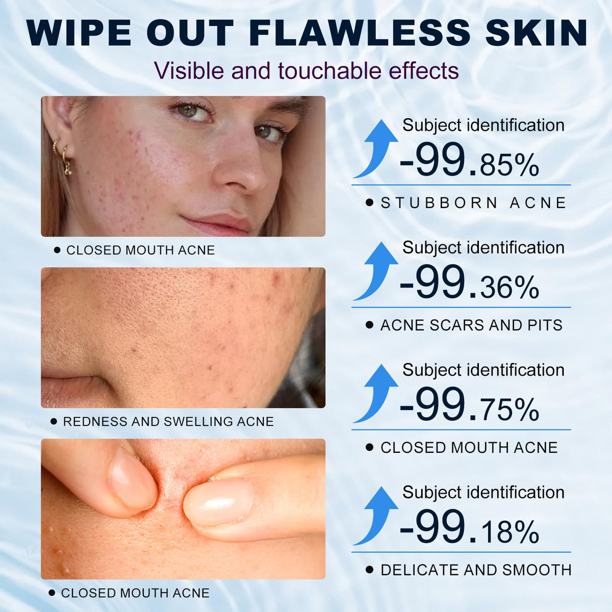 Marianp applied to cheek illustrating targeted redness reduction