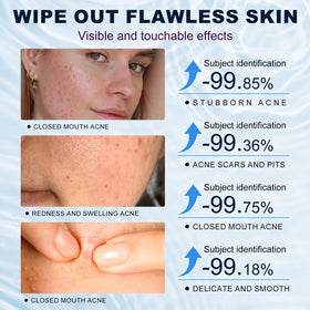 Marianp applied to cheek illustrating targeted redness reduction