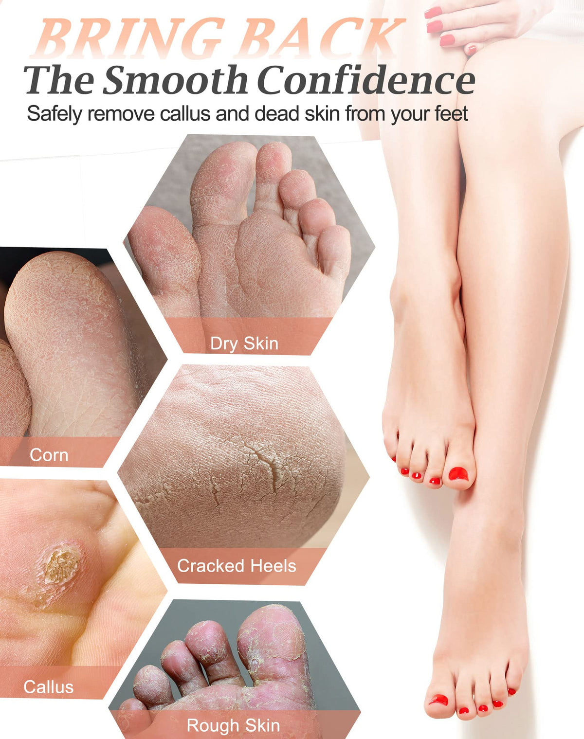 MARYTON pumice in use scrubbing foot after soak to soften rough skin