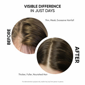 Masofta being applied to scalp with finger massage, shows targeted scalp care benefit
