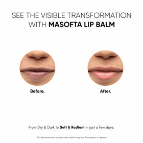 Masofta in outdoor sunlight illustrating SPF protection