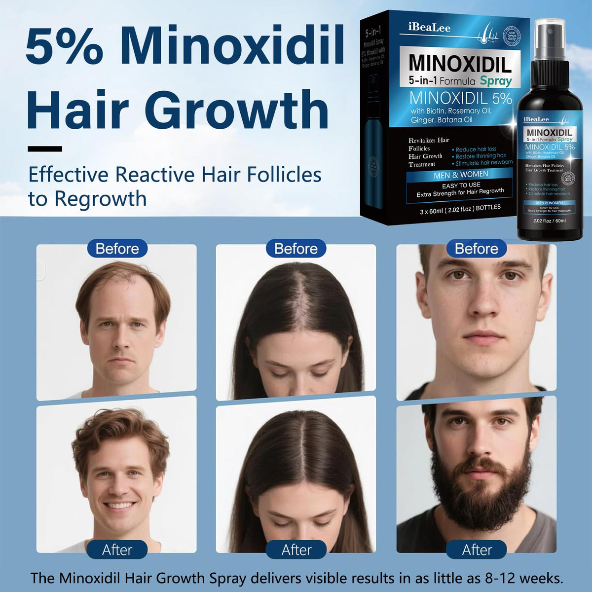 MAYFERTE applied to scalp demonstrating targeted delivery for thinning areas