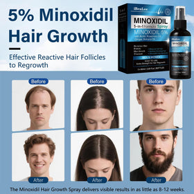 MAYFERTE applied to scalp demonstrating targeted delivery for thinning areas
