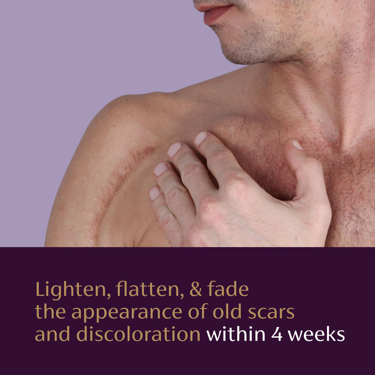 Concept before-and-after images for Mederma scar serum showing reduced discoloration over time