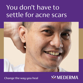 Mederma product label highlighting active ingredients for transparent formulation benefits