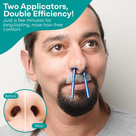 Medi Grade disposable tips close-up indicating hygienic single-use benefit