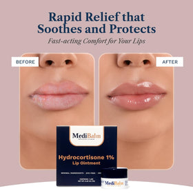 MediBalm texture swipe showing glossy moisturizing finish benefit