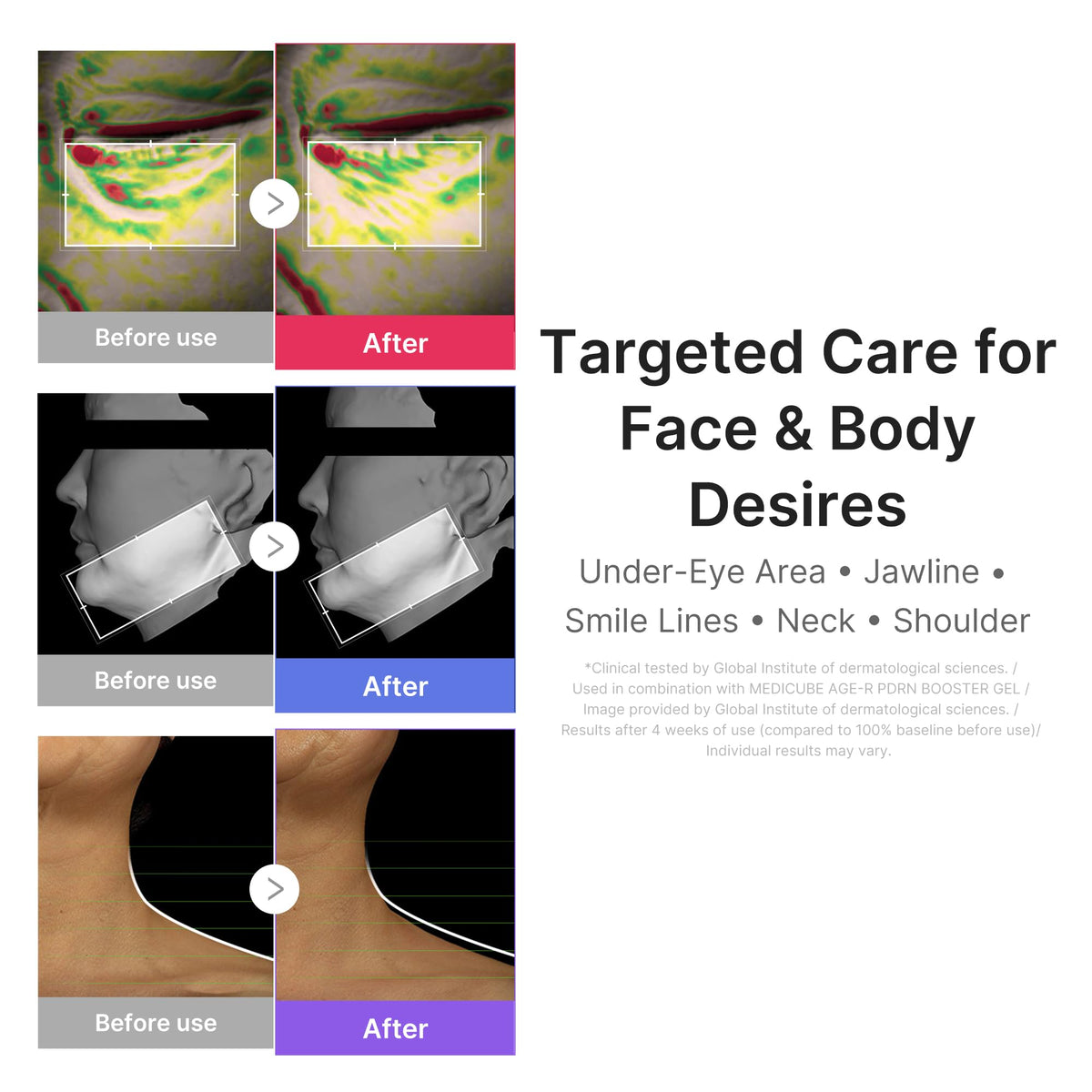 medicube smartphone showing AGE-R App pairing for customized control
