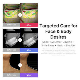 medicube smartphone showing AGE-R App pairing for customized control