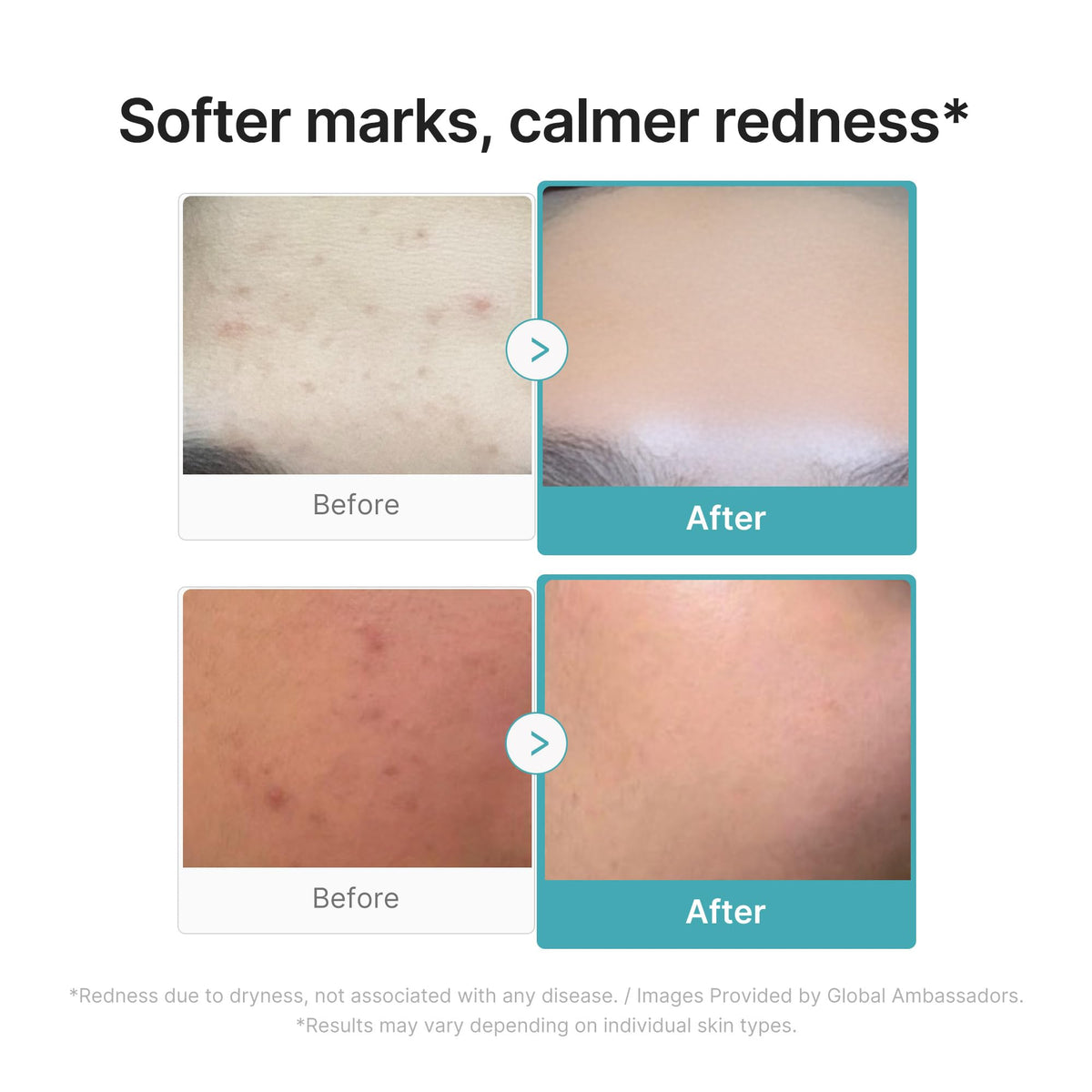 medicube label close-up emphasizing 10% azelaic acid strength benefit