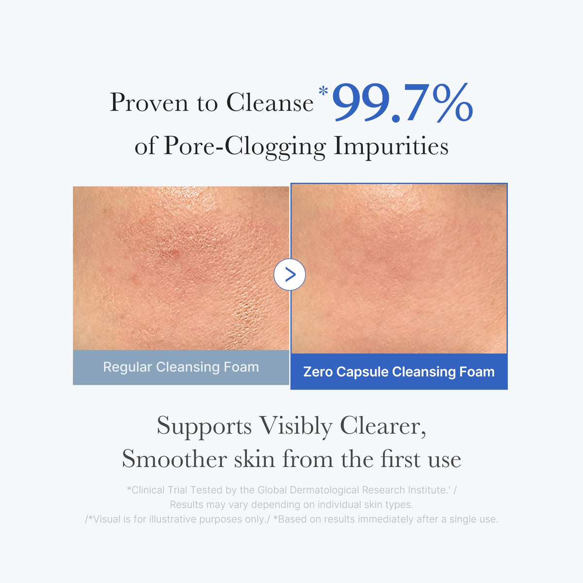 medicube blue capsule close-up showing exfoliating capsules that target sebum and blackheads